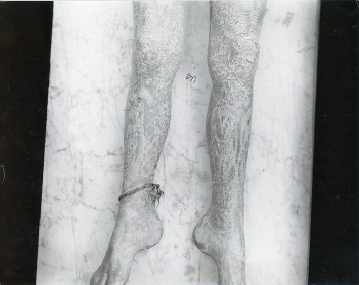 Sally Mann Marcuse Pfeifer Gallery